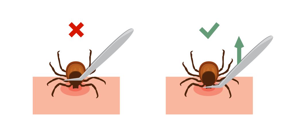 how to remove a tick from a dog